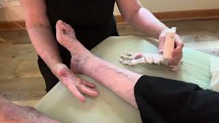 Part 1Hammer Toe Metatarsalgia BunionsMyofascial Treatment Solutions [upl. by Gaultiero]