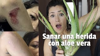 Sanar una herida de manera natural Aloe vera [upl. by Faruq]