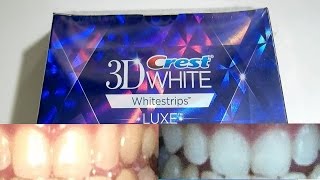 Guy with yellow teeth tests out whitening strips for 20 days Crest 3D Whitestrips [upl. by Demetrius]