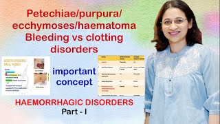 Petechiaepurpuraecchymoseshaematoma Clinical presentation of vesselplateletclotting disorders [upl. by Mun]