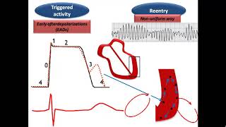 ECG course Torsades de Pointes Dr Sherif Altoukhy [upl. by Neellek155]