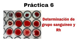 Práctica 6 Determinación de grupo sanguíneo y Rh [upl. by Cristobal671]