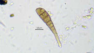 Growing of hyphae and septa formation in Alternaria sp  fast time lapse [upl. by Desireah]