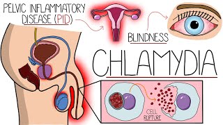 Understanding Chlamydia Chlamydia Trachomatis Explained Clearly [upl. by Walrath912]