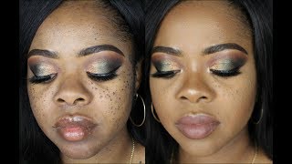 How To I Cover my MolesFreckles Foundation Only  BrownDark Skin [upl. by Emmett955]