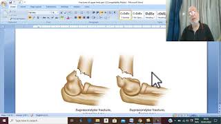 Orthopedic in Arabic 15  Supracondylar fracture  part 1  by Dr Wahdan [upl. by Eatnuahc]