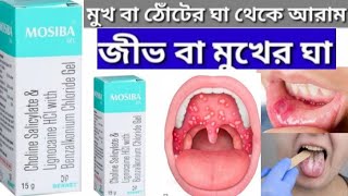 mosiba gel use in bengali [upl. by Gytle809]