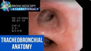 Flexible Bronchoscopy Introduction 7  Airway Inspection Tracheobronchial Anatomy [upl. by Kali]