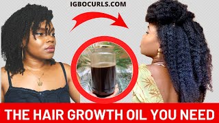 DIY Extreme Hair Growth Serum  Powerful Homemade Serum For extreme Hair Growth [upl. by Theressa]