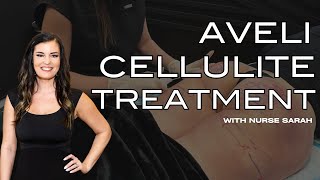 Aveli Cellulite Treatment with Nurse Sarah [upl. by Scheers]