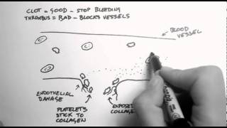 Haemostasis 1  Clots Thrombi amp Antiplatelets [upl. by Beulah]