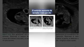 EL EMBRIÓN AUMENTA DE TAMAÑO 1 mm POR DIA [upl. by Fulbert]