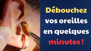 Oreille bouchée  causes et solutions efficaces Fact24h [upl. by Eart]