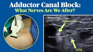 Adductor Canal Block What Nerves Are We After [upl. by Cesaria]