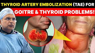 Why Thyroid Artery Embolization TAE is The Best Treatment For Goitre amp Thyroid Related Problems [upl. by Aivekahs]