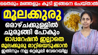 ഓപ്പറേഷൻ ഇല്ലാതെ മൂലക്കുരു മാറ്റിയെടുക്കാൻ ഇതിനും നല്ല ഒറ്റമൂലി വേറെയില്ല [upl. by Crellen214]