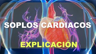 Soplos del corazon soplo cardiaco [upl. by Ttelrahc]