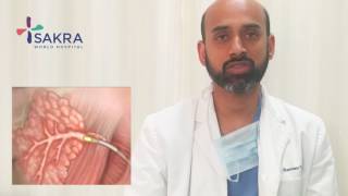 Sialoendoscopy Procedure  ENT Specialist in Bangalore  Dr Shantanu Tandon  Sakra World Hospital [upl. by Enaamuj893]