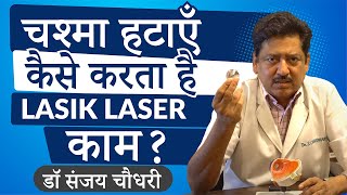 What is Lasik Laser amp what are the options in Lasik Laser eye surgery in Hindi  Eye7 New Delhi [upl. by Leta]