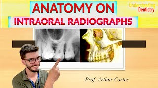 ALL ANATOMICAL LANDMARKS of maxilla and mandible Periapical X Ray and Radiographs Dental Anatomy [upl. by Knowle403]