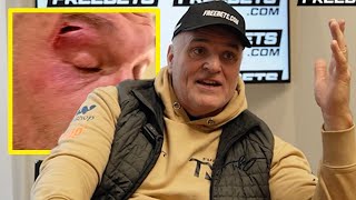 TYSON CUT HIS OWN EYE NOTHING OUT OF MY NUTSACK  John Fury RAGING at Usyk team [upl. by Nossah]