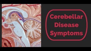 Cerebellar Disease Symptoms [upl. by Linus]