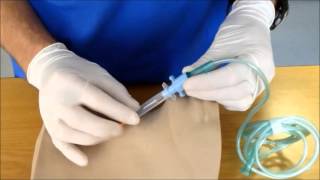 Needle Cricothyroidotomy [upl. by Lleinnad510]