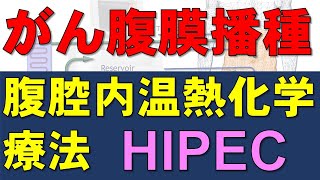 がんの腹膜播種に対する腹腔内温熱化学療法 HIPEC：卵巣癌での研究結果 [upl. by Nnek]