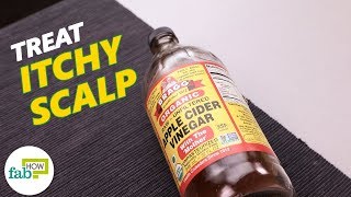 How to Get Rid of Itchy Scalp Top 3 Home Remedies [upl. by Nirhtak]