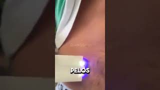 Depilador 2x1 Láser Multifuncional con Tecnología AntiIrritación  LaserLux™ [upl. by Rebhun806]