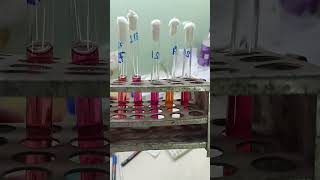 Lab Centrifuge Urine Culture growth Sample Culture plate biochemistry Abo blood group Antisera A [upl. by Seldun141]