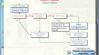 SimCode ACLS™  Asystole Tutorial [upl. by Penrod]