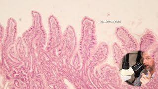 Microscopic anatomy of the small intestine [upl. by Eenet]