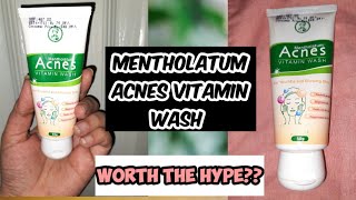 Mentholatum Acnes VITAMIN Face WashHonest ReviewIs it worth the hype [upl. by Anaic]