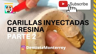 CARILLAS DIRECTAS PASO a PASO👅Parte 2 Técnica de Inyección carillasderesina [upl. by Sergo]