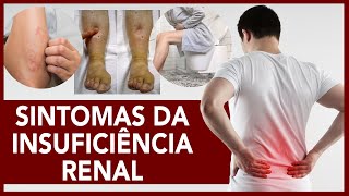 Sintomas da insuficiência renal [upl. by Deidre]