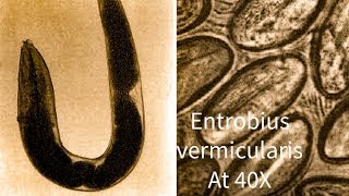 Entrobius vermicularis Pin Worm under microscope at 40 X [upl. by Atiuqahc]