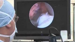 Equine Arthroscopic Surgery [upl. by Ramirolg]