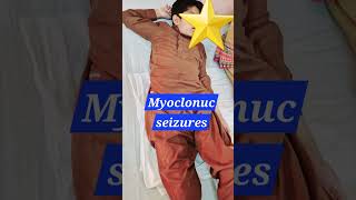 Myoclonic seizures  Myoclonus  SSPE  Epilepsy pediatrics neurology doctor [upl. by Lancey]