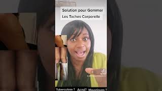 Solution pour Gommer les Taches noires au niveau du corps [upl. by Prior]