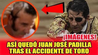 ASÍ QUED0 JUAN JOSÉ PADILLA TRAS ACC1DENTÊ DEL T0R0 [upl. by Sall]