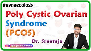 Poly Cystic Ovarian Syndrome PCOS  Stein–Leventhal syndrome  Hyperandrogenic anovulation [upl. by Sissel]