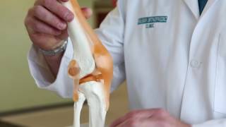 What is Runner’s Knee  Pain in knee when walking  Runners Knee Pain [upl. by Aikal]