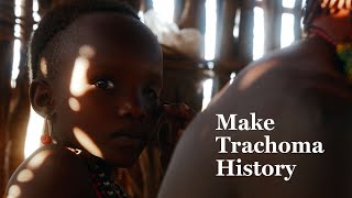 Make Trachoma History  Orbis UK [upl. by Nosduh1]