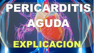 Pericarditis Aguda Qué es síntomas tratamiento [upl. by Geri833]