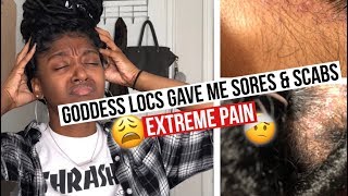 Getting Faux Locs Pain Sores amp Scabs  HeyLayah [upl. by Ihsorih620]