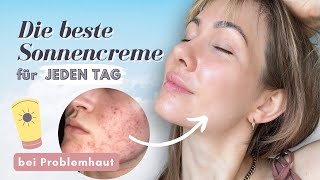 Die beste Sonnencreme🧴☀️ fürs Gesicht  ölige unreine Haut amp Akne [upl. by Prakash]