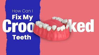 How Can I Fix My Crooked Teeth Malocclusion  Causes Prevention Treatment and More [upl. by Consuelo914]