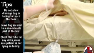 Instructional Video for Empty Urinary Drainage Bag [upl. by Ailido185]