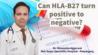 Can HLAB27 turn positive to negative [upl. by Hawk462]